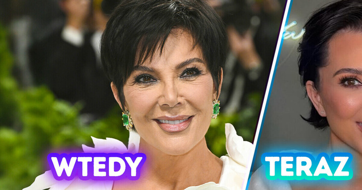 „Najlepszy lifting w historii” — 69-letnia Kris Jenner wygląda o połowę młodziej po operacji, a ludzie uważają, iż przypomina Kim
