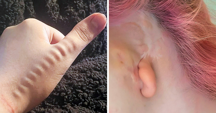 15 niezwykłych cech ludzkiego ciała, na które nie byliśmy przygotowani