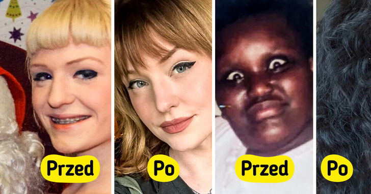 15 osób, które zmieniły się z pięknych w oszałamiające