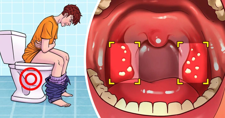 10 oznak, iż twój organizm może nie tolerować glutenu