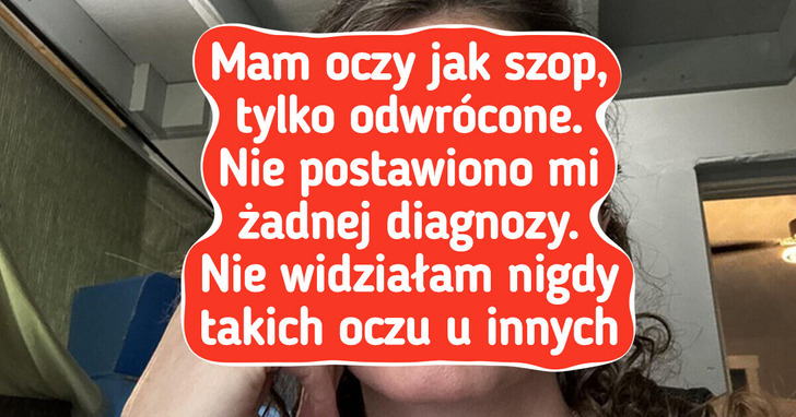 15 osób, które natura obdarzyła wyjątkowymi cechami