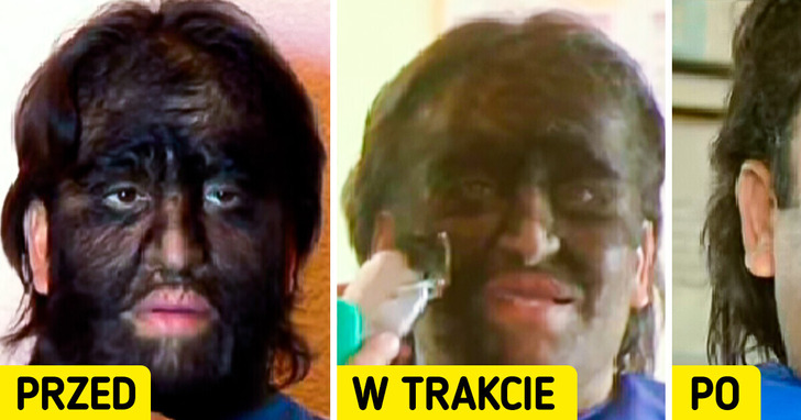 „Ludzie nazywają mnie dziwakiem” — człowiek-wilk stara się znaleźć pracę poza cyrkiem