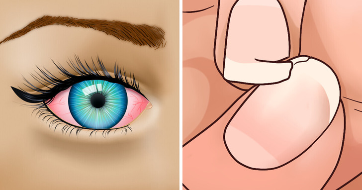 10 sygnałów świadczących o tym, iż możesz mieć problemy z tarczycą – kobiety są bardziej podatne