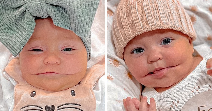 Poznajcie małą Aylę, dziewczynkę, która zawsze się uśmiecha i chwyta ludzi za serce wrodzoną wadą ust