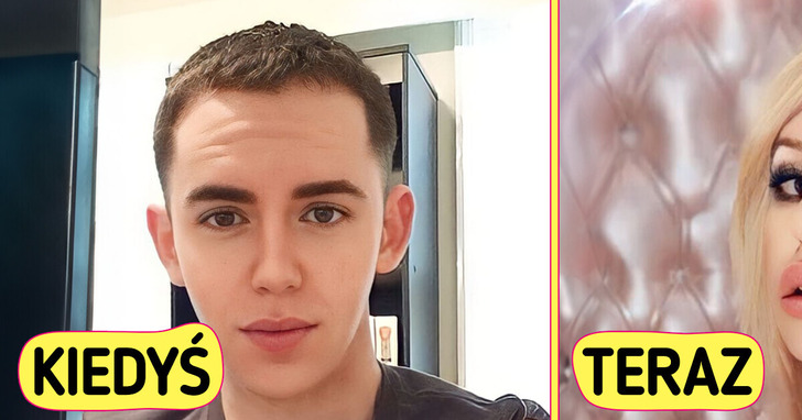 Wydałem ponad 100 000 $ na operacje plastyczne, aby zmienić się w Britney Spears