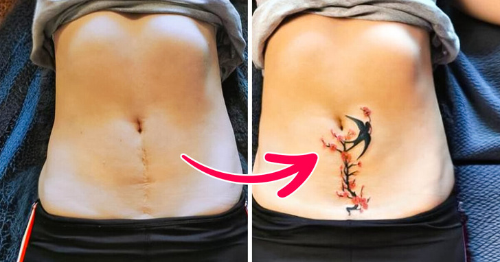 16 tatuażystów, którzy zamienili blizny w dzieła sztuki