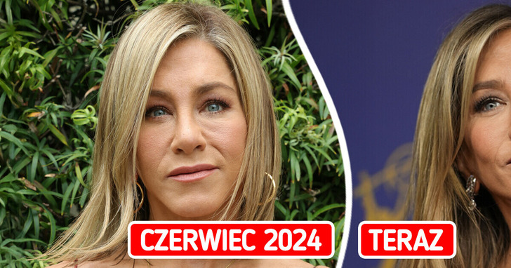 Jennifer Aniston szokuje nowym wyglądem – oficjalnie pożegnała się z wypełniaczami