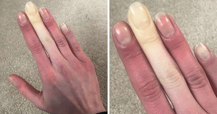 12 przykładów na to, jak niezwykle kreatywne potrafi być ludzkie ciało