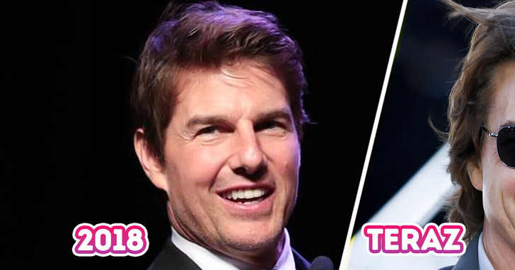 „Dość tych liftingów” — zmiany w wyglądzie Toma Cruise’a wzbudzają podejrzenia, iż przesadza z wypełniaczami