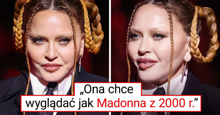 Niewiarygodnie młodzieńcza twarz Madonny wprawia wszystkich w osłupienie, a bliskie jej źródło ujawnia motywację piosenkarki