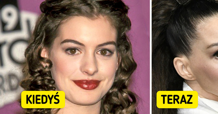 Anne Hathaway zachwyciła na Met Gali 2025 — fani jej nie poznali