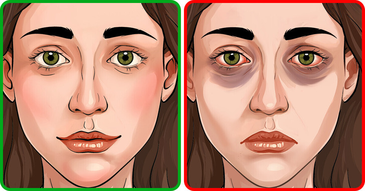 4 objawy astmy, które mogą umknąć twojej uwadze