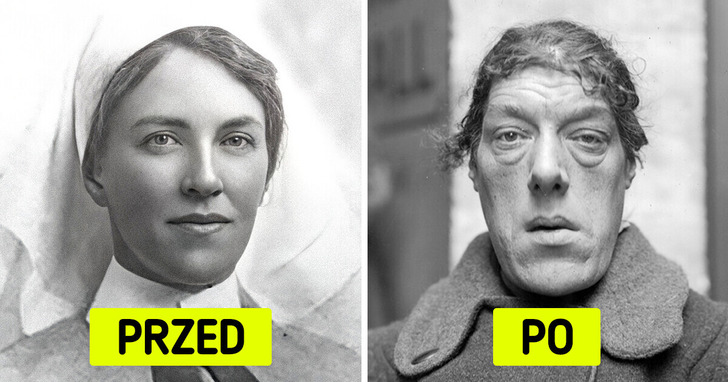 Tragiczna historia matki, która zdecydowała się być "najbrzydszą kobietą", by ocalić swoje dzieci