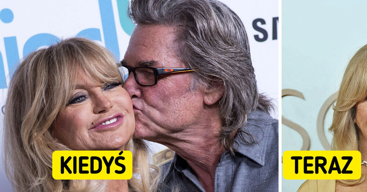 „Jej twarz. Co się stało?”. Goldie Hawn ujawnia, na co cierpi, ale ludzie widzą jedno