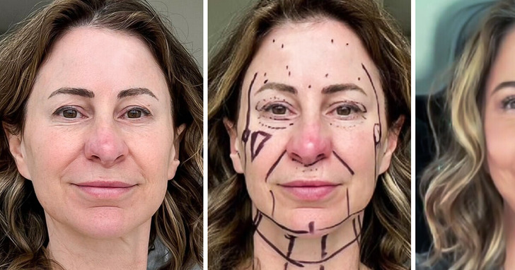 Sprzedałam dom, żeby zrobić sobie lifting twarzy. Teraz wyglądam 20 lat młodziej i mieszkam w vanie