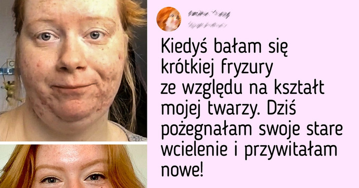 13 osób, które zaakceptowały swoje niedoskonałości i zaczęły żyć pełnią życia