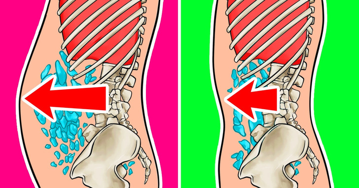 Jak uporać się ze wzdęciami