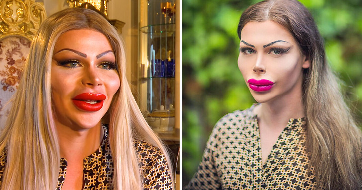 Wydałem 58 tysięcy funtów na operacje plastyczne i w najbliższym czasie nie zamierzam przestać