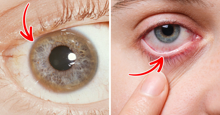 12 nietypowych zmian w oku, które mogą zwiastować poważne problemy zdrowotne