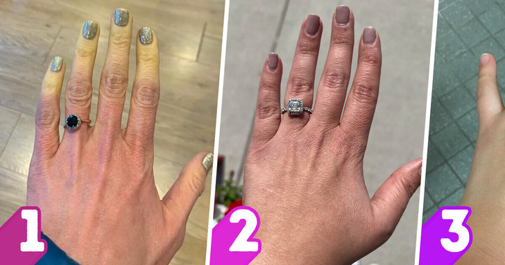 9 ostrzeżeń, jakie wysyłają twoje dłonie na temat zdrowia