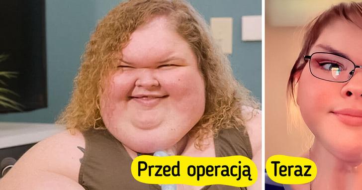 „Jestem z ciebie dumna” — niesamowita przemiana gwiazdy programu „Siostry wielkiej wagi” po operacji usunięcia skóry