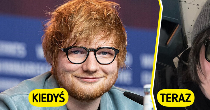 Ed Sheeran zmienił się nie do poznania — fani oniemieli
