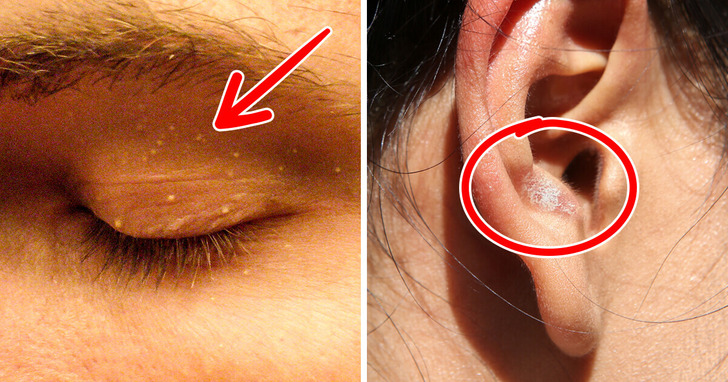 6 subtelnych oznak na twarzy, które mogą ujawniać poważne problemy zdrowotne