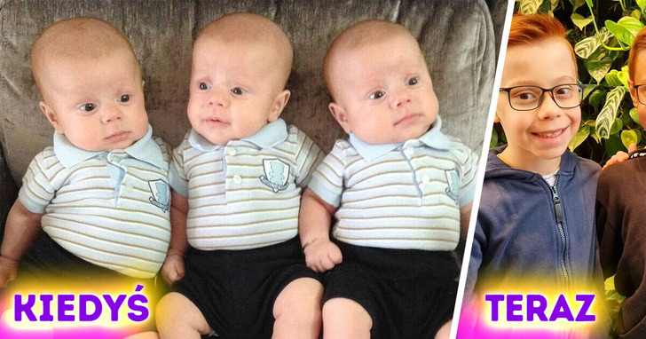 Oto niezwykle rzadkie identyczne trojaczki. Poznajcie jedyny sposób, w jaki ich rodzice potrafią je rozróżnić!