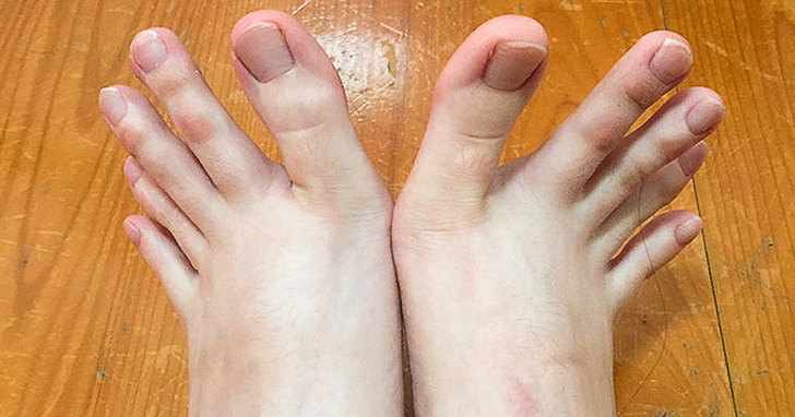 Ludzie podzielili się zdjęciami swoich nietypowych części ciała, zupełnie zaskakując innych internautów