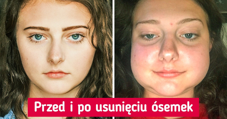 20 dowodów na to, iż niektórzy ludzie mogą mieć dziś gorszy dzień niż ty