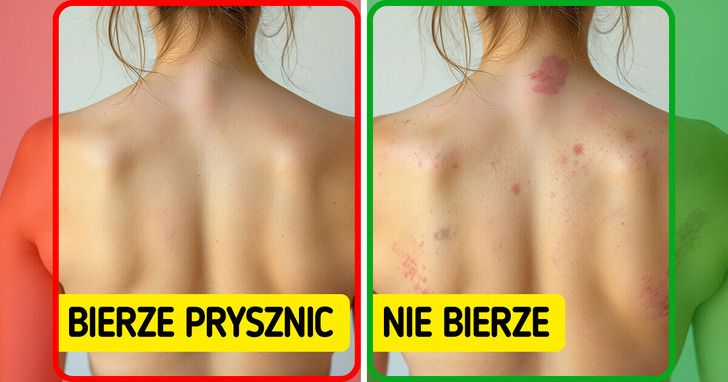 8 rzeczy, które mogą się wydarzyć, gdy przestaniesz się myć