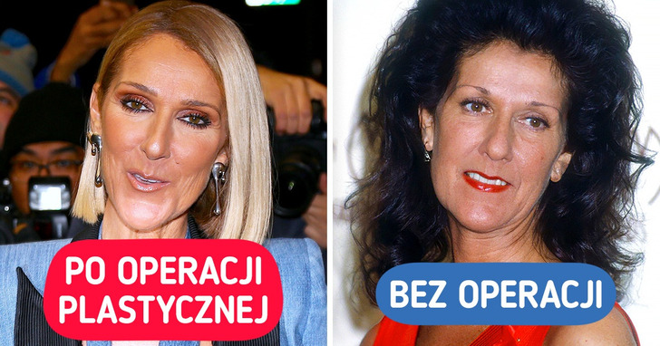Jak wyglądałoby dziś 17 gwiazd, gdyby nie poddały się zabiegom medycyny estetycznej