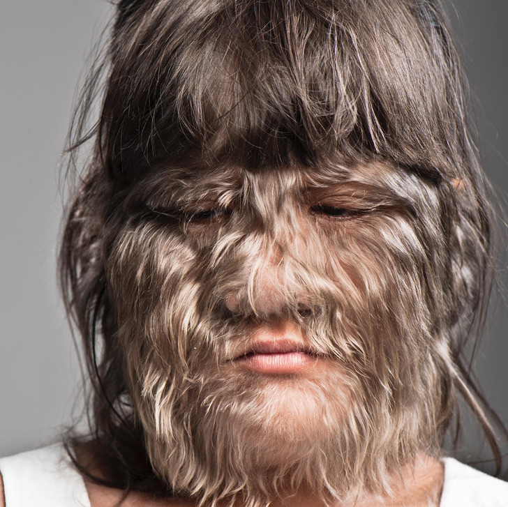 Close-up of a little girl looking sad, her face covered with fur-like hair.