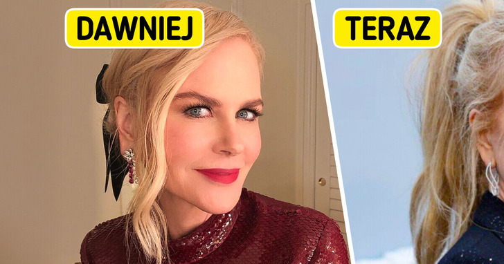 „Wskaźniki liftingu twarzy w pobliżu uszu” — Nicole Kidman szokuje swoją ostatnią przemianą, a ludzie zauważają jeden szczegół