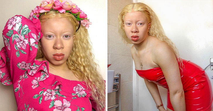 19 modelek, które udowadniają, iż wreszcie nadszedł czas innego piękna