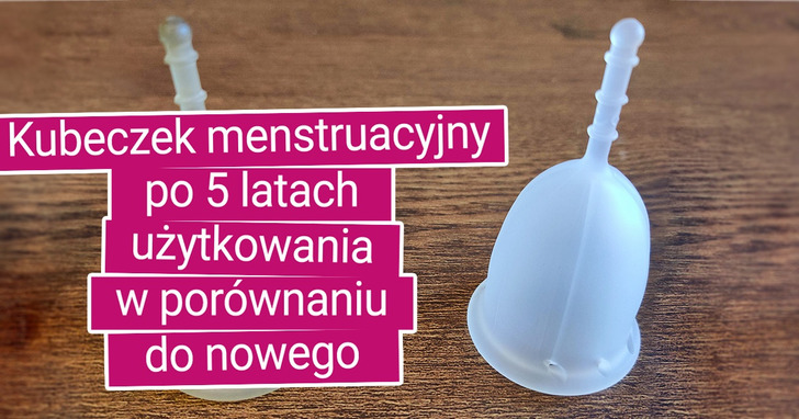 17 zdjęć, które obrazują upływ czasu lepiej niż jakiekolwiek słowa
