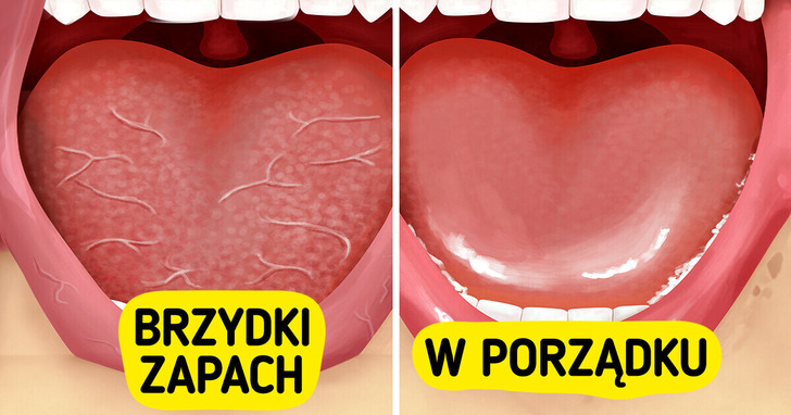 6 efektywnych metod zapobiegania nieświeżemu oddechowi, również po przebudzeniu
