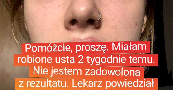 17 dziewczyn pokazuje, jak zmienił się ich wygląd po zabiegach medycyny estetycznej