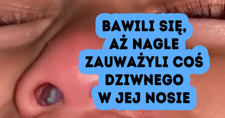 Matka znalazła w nosie córki coś, co sprawiło, iż zaniemówiła