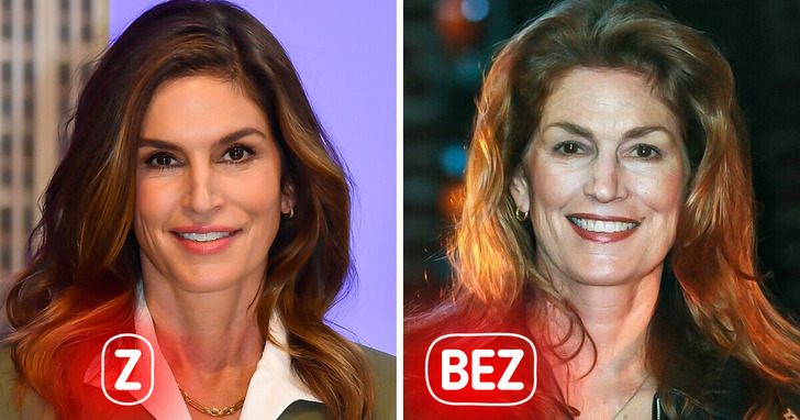 16 gwiazd — jak by wyglądały bez operacji plastycznych