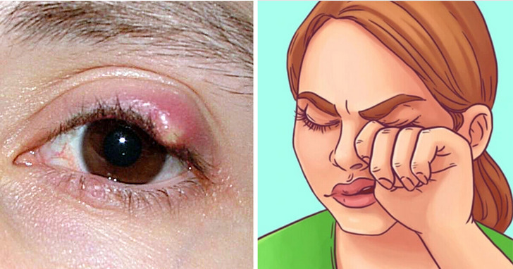 10 rzeczy, które oczy mogą powiedzieć o stanie twojego zdrowia