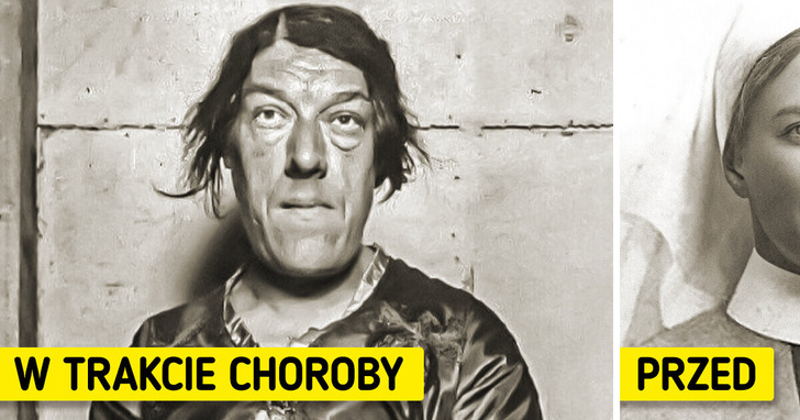 Wzięła udział w konkursie na najbrzydszą kobietę, aby zarobić na swoje dzieci