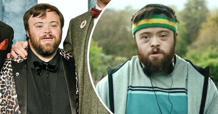 Poznajcie Jamesa Martina, pierwszego aktora z zespołem Downa, który zdobył Oscara