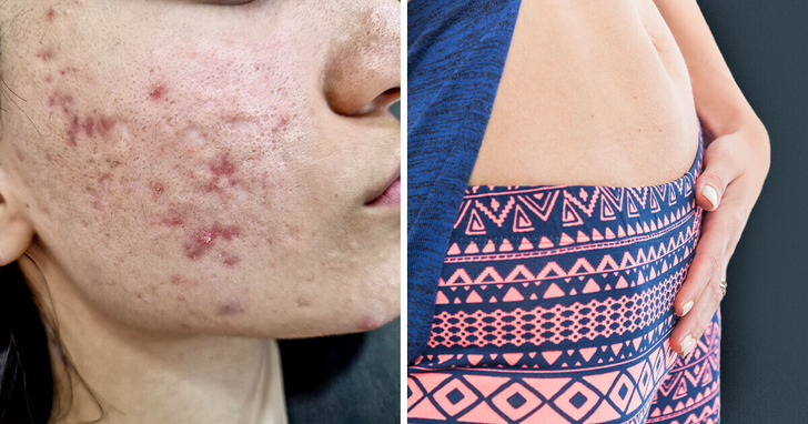 5 sposobów, w jakie szpinak może po cichu szkodzić zdrowiu