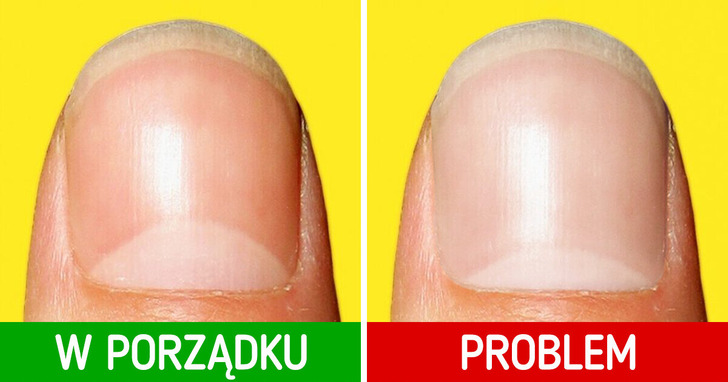 10 sygnałów, które wysyła ci ciało, aby powiedzieć, iż dzieje się coś niedobrego