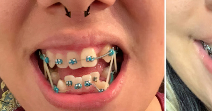 15 photos that prove that all  tooth can be transformed into a perfect smile