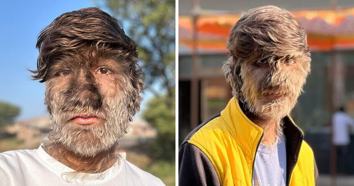 Chłopak, którego w młodości rówieśnicy nazywali "małpą", na przekór wszystkim założył własnego Vloga