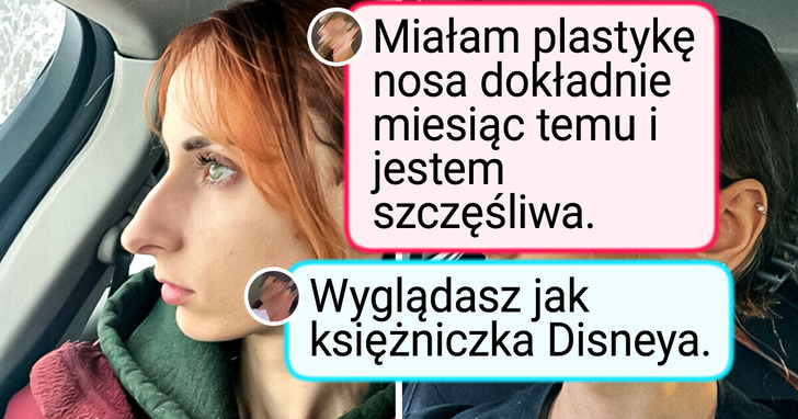 13 zestawień zdjęć „przed i po”, które pokazują niezwykłą metamorfozę