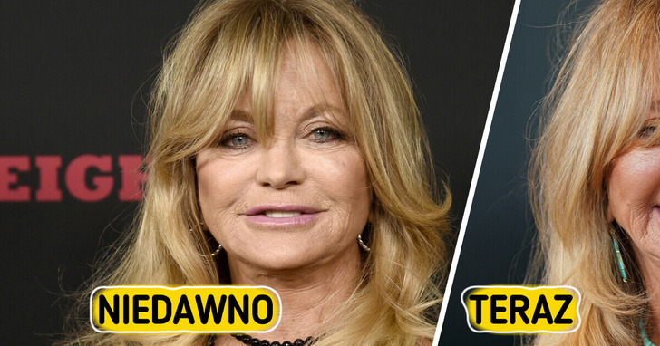 „Co z jej ustami?” — Goldie Hawn olśniewa na czerwonym dywanie, ale niektórzy mówią tylko o jednym